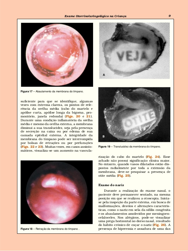 otorrinolaringologia vicente diamante pdf